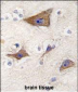 LGR5 (GPR49) Antibody (Center)